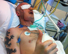Poland claims world’s first life-saving face transplant